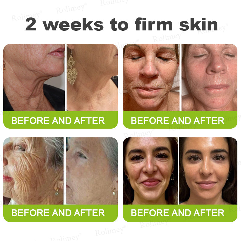 👨🏻‍⚕️ Made and shipped from the USA Rolimey® Botox & Vita-A Retinol Shot Wrinkle-Lift Tightening cream - Last Day Promotion 70% OFF