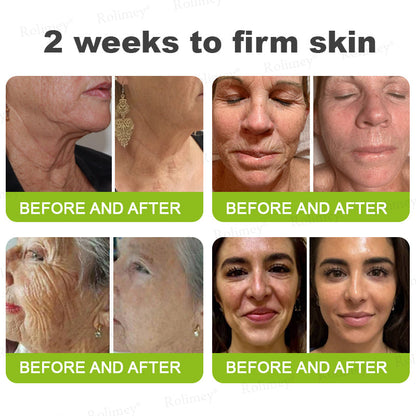 👨🏻‍⚕️ Made and shipped from the USA Rolimey® Botox & Vita-A Retinol Shot Wrinkle-Lift Tightening cream - Last Day Promotion 70% OFF