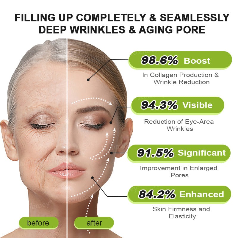 👨🏻‍⚕️ Made and shipped from the USA Rolimey® Botox & Vita-A Retinol Shot Wrinkle-Lift Tightening cream - Last Day Promotion 70% OFF