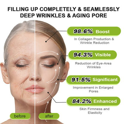👨🏻‍⚕️ Made and shipped from the USA Rolimey® Botox & Vita-A Retinol Shot Wrinkle-Lift Tightening cream - Last Day Promotion 70% OFF