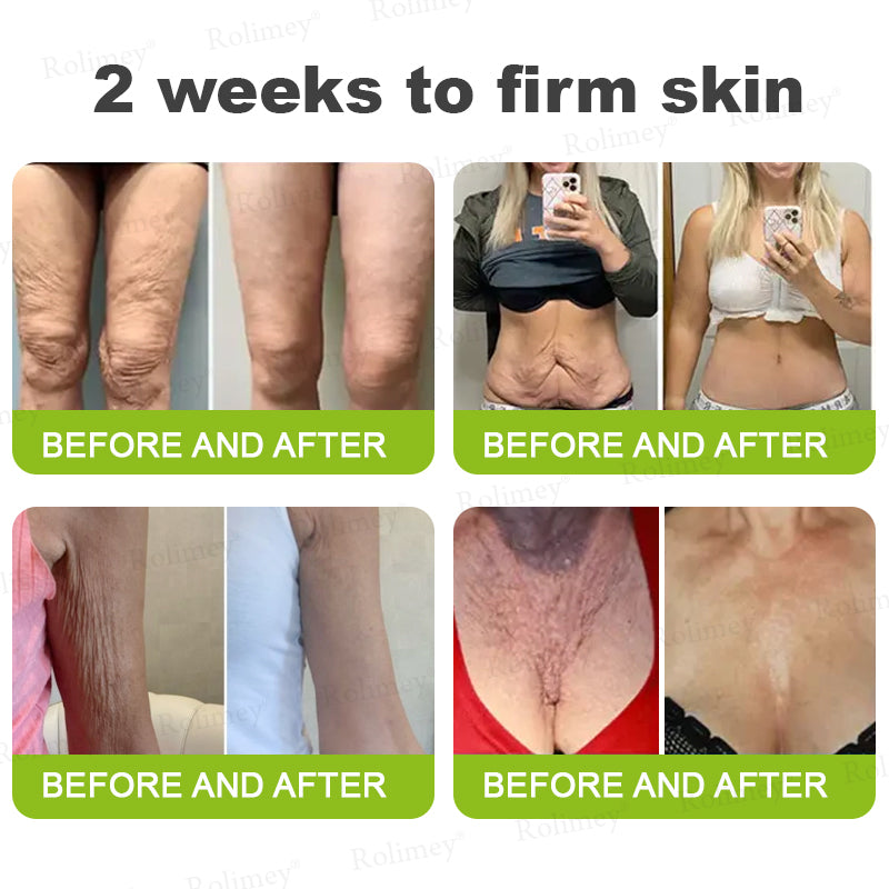 👨🏻‍⚕️ Made and shipped from the USA Rolimey® Botox & Vita-A Retinol Shot Wrinkle-Lift Tightening cream - Last Day Promotion 70% OFF