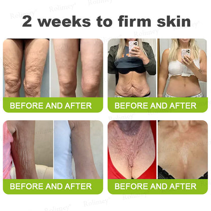 👨🏻‍⚕️ Made and shipped from the USA Rolimey® Botox & Vita-A Retinol Shot Wrinkle-Lift Tightening cream - Last Day Promotion 70% OFF