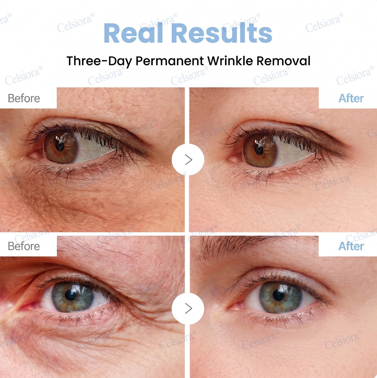🥈Celsiora® PDRN Anti-Wrinkle Shot – Lift & Firming Cream (upsell)