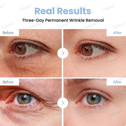 🥈Celsiora® PDRN Anti-Wrinkle Shot – Lift & Firming Cream (upsell)